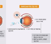 대웅, ‘점안제형’ 당뇨망막병증 치료제 임상1상 승인