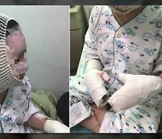 '새 신부' 경찰관의 눈물..."화염으로 손가락 붙어 맨살 긁어낸다" [Y녹취록]