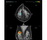 루닛, 英리즈대병원과 AI 활용 유방암 전향적 연구 계획 발표