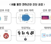 목소리만으로 뇌졸중 후 연하장애 조기 진단 가능