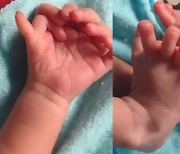 손가락 14개·발가락 12개 갖고 태어난 아기… 부모는 “신의 재림”