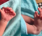 ‘손·발가락 26개’로 태어난 아기…“여신 재림” 인도 가족 환호