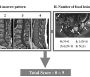 난치성 질환인 '다발골수종' 병기 평가하는 新 MRI 점수모델 개발