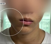 “고등 교사가 학생 폭행”…‘분리조치’ 없어