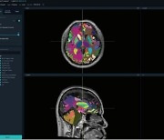 VUNO wins FDA approval for AI-based brain imaging analysis medical device