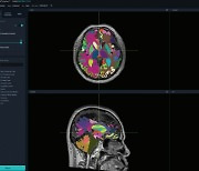 뷰노 AI 기반 뇌 MRI 분석기기 ‘딥브레인’, FDA 인증 획득