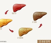 "저체중 출생아, 지방간 위험 '헉'