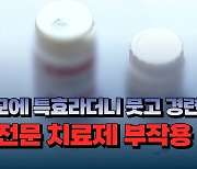 [자막뉴스] 탈모에 특효라더니 붓고 경련 발생... 비전문 치료제 부작용 주의