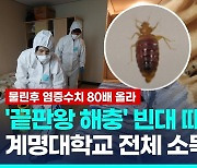 [영상] 대구 계명대도 빈대 출몰…"2차 감염에 염증 수치 80배"