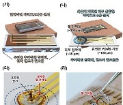 피부에 붙이기만 해도 당뇨 관리…피부 부착형 '혈당 센서' 나오나