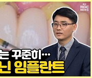 [약손+] 치주질환 치료와 예방 ⑨끝이 아닌 임플란트