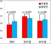 KBSI "우울증 여성은 해마 타우린 농도 20% 낮아"