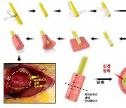 로봇 팔다리로 생활하는 세상이 가까워졌다