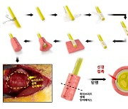 절단환자 위한 로봇 팔·다리 정밀 제어 '생체인터페이스' 개발