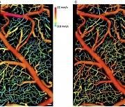 핏속 적혈구 움직임 직접 본다···혈관질환 연구에 기여