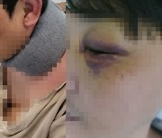 “니네 아빠 X발렸다”···아들 앞에서 무자비한 폭행 당한 아버지 [영상]