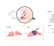 주름 개선용 필러 소재로 손상된 근육 재생·재활 돕는다