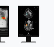 루닛, 북미 영상의학회서 흉부·유방 AI 분석 결과 공개