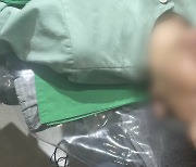 "유명연예인 눈·코도 여기서"…강남 성형전문의 둔갑한 간호조무사