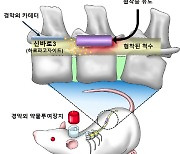 "천연물로 척추관협착증 극복한다"