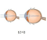 "아트로핀, 근시 진행 억제 효과 재확인"