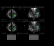 루닛, 3D 유방암 검진 '루닛 인사이트 DBT' 美 FDA 승인 획득