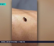 충주서도 빈대 출현 확인.. 도내 첫 사례 '긴급 방역 소독'