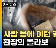 [자막뉴스] 이상한 아킬레스건 갖고 다니며 불법 의료 행위까지... 6천5백여 명이 당했다