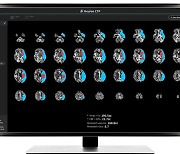 "AI, 뇌손상 응급환자 수분내 선별"…휴런, 국내 첫 인증