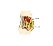 "내장지방 많으면 치매 위험 높아져"