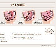 여성이라면 누구나 위험한 골반장기탈출증, ‘로봇수술’로 해결