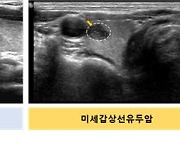 갑상선암, 종양 작아도 초음파검사서 ‘이것’ 확인되면 위험