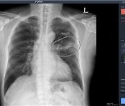 의료 AI 설루션, 정부 지원 힘입어 각국 군병원 속속 공급