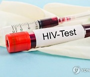 中 노인 HIV 감염 7년새 54%↑…남서부 지역·저학력자에 집중