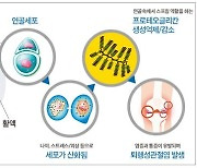 [건강한 우리집] 삶의 질 떨어트리는 관절염 통증, 연골세포 손상 때문