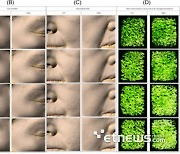 하이로닉 “브이로리프팅 HIFU+RF 결합 시술 시너지 효과 입증”