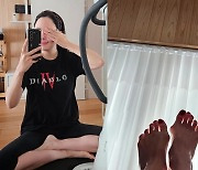 '백종원♥' 소유진, 변형된 발 공개…수술 고민까지 '심각'