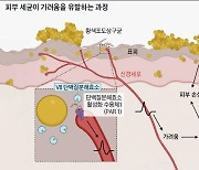 [이영완의 사이언스카페] “아토피 가려움, 피부 세균이 범인” 첫 확인