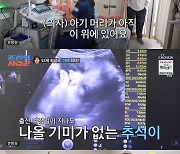 최성국, 진통 없는 아내 걱정…"노력했지 않냐" 결국 제왕절개 하기로