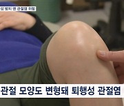 무심코 지나간 겨울철 낙상, 방치하면 관절염 키운다