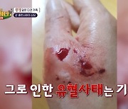 배은망덕犬 루비, 구조해준 보호자 손 물어 유혈사태 (개훌륭)[결정적장면]