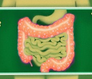 암 면역 요법 부작용, “‘장내 미생물’ 때문에 발생한다”