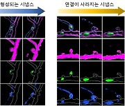 시냅스 구조 변화 과정 ‘찰칵’… 뇌 질환 극복 단서 찾는다