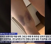 부산 오피스텔서 20대女 추락사…유족 "스토킹 당해"