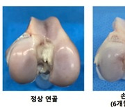 강스템바이오텍, 연골재생 골관절염 치료제 1분기 임상 1상 투약 완료 목표