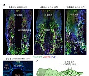 뇌 속 노폐물 청소해 치매 막는다···뇌척수액 배출 경로 찾았다