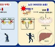 비타민D만 잘 챙겨도..."노화로 인한 지방간 억제해준다"