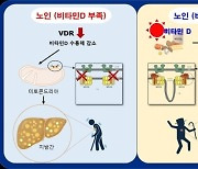 비타민D 섭취, 간암·치매 일으키는 지방간 줄일 수 있다