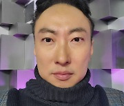 박명수, 쌍꺼풀→지방재배치…이번엔 "안검하수 수술계획"