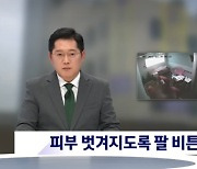 피부 벗겨지도록 팔 비틀어…'노인 학대' 요양보호사 재판행